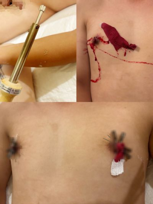 �P�����l