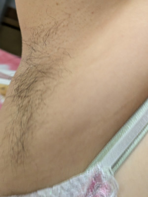 取手